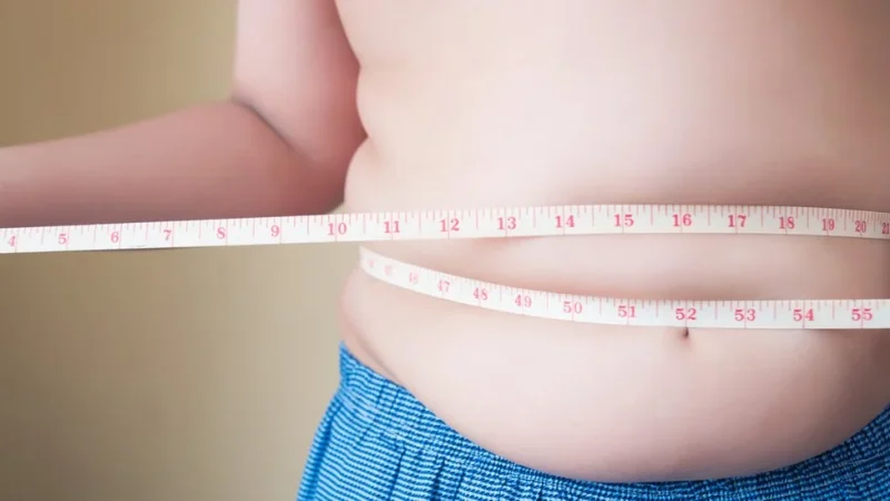 La obesidad es un problema de salud mundial