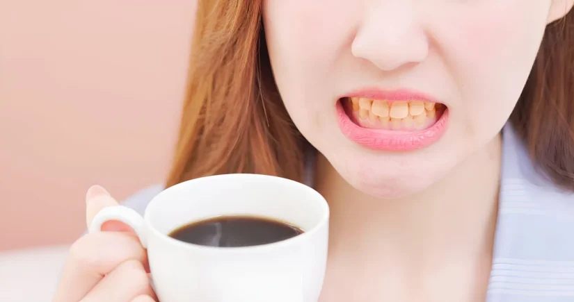 El truco definitivo para que el café no te manche los dientes 88 Merca2.es ¿Qué hacer si los dientes ya presentan manchas?