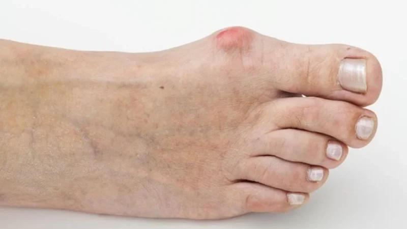 Hay investigaciones que defienden estos los beneficios