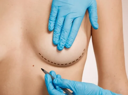 cirugia estética cirugia estética