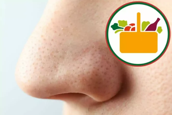 Consejos para cuidar los poros y evitar su obstrucción