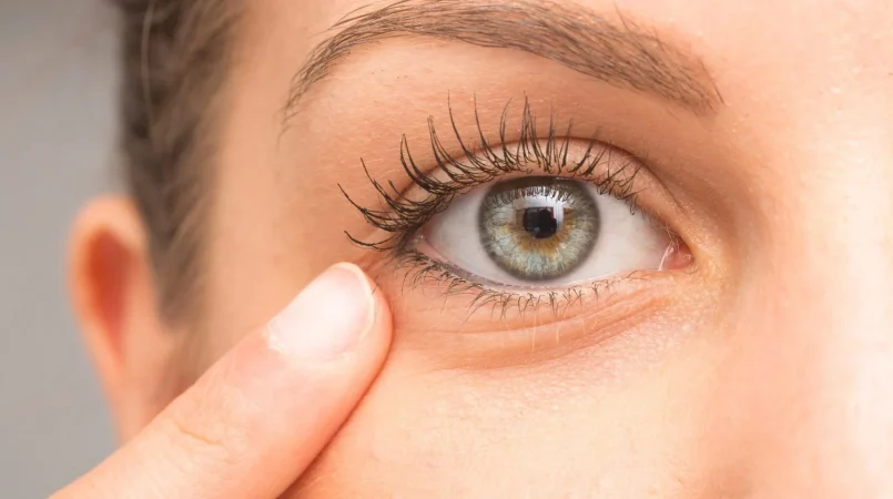 Descubre si tienes falta de la importante Vitamina D con estos característicos signos 13 Merca2.es ¿Por qué es que tanta gente tiene tan poca?