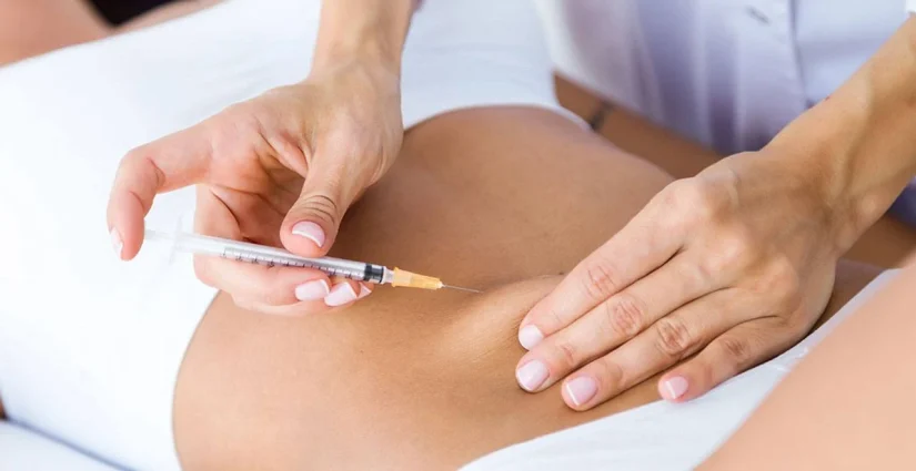 Pronto podrás decir adiós a los michelines de más con un simple pinchazo, como una liposucción, pero sin quirófano 84 Merca2.es La opinión de los expertos sobre esta nueva forma de eliminar los michelines