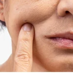 Dra. Ana Molina (45 años), dermatóloga: «El que fuma 20 años parece 1000 veces más mayor»