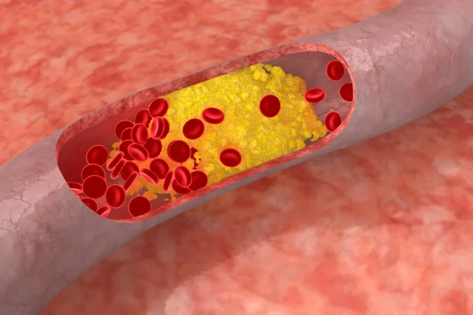 Colesterol: la verdad que no te han contado. El 80% lo baja mal y pone en riesgo su corazón 2 Merca2.es El mensajero del cuerpo Merca2.es