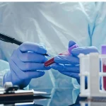 Dr. Alberto Melón (39), hematólogo: “No tener asteriscos en una analítica no significa que estés bien”