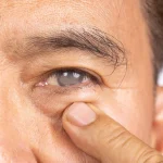 Dr. Alberto Sanagustín, mádico de familia: «Es crucial usar gafas de sol con protección 100% contra rayos UVA o V para retrasar la aparición de cataratas»