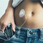 ¿Molesta, se nota, limita? Ares Teixidó (38) presentadora y actriz, con diabetes tipo 1, responde sin filtros sobre la portabilidad de la bomba de insulina