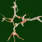 Dr. Rodolfo Alcedo, neurocirujano endovascular: «Una de cada 50 personas camina por ahí con un aneurisma sin saberlo»