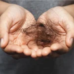 Caída del pelo: Las 5 recetas naturales que más resultados dan según la ciencia
