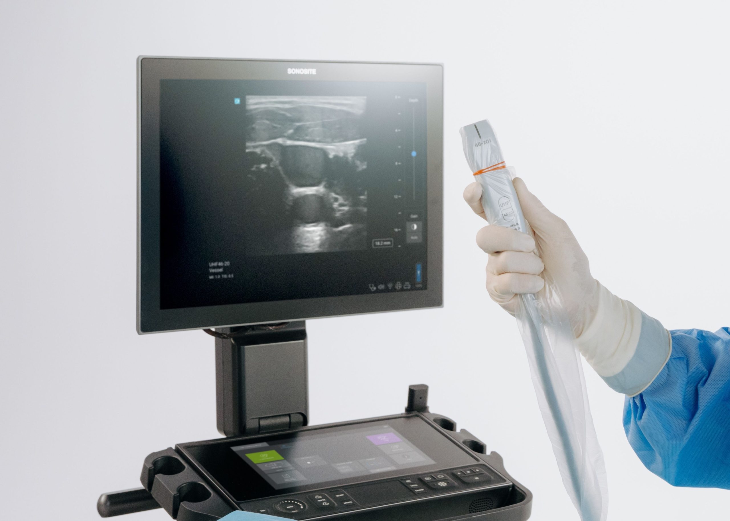 Sonosite LX introduce la ultra-alta frecuencia en POCUS con el primer y único transductor de 46 MHz