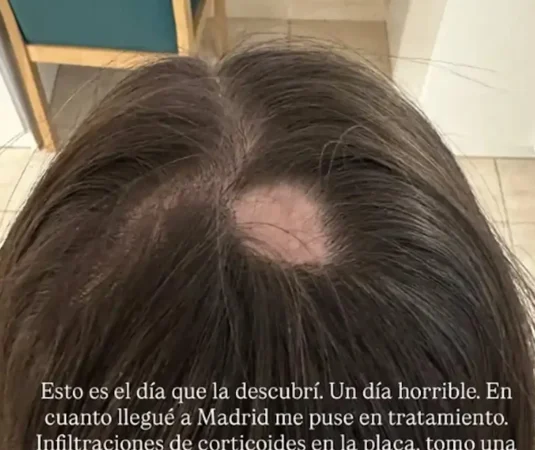 Alexia Rivas diagnostico Merca2.es