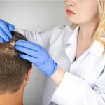 De peor a mejor: el ranking real de los tratamientos tópicos contra la alopecia que recomiendan los expertos