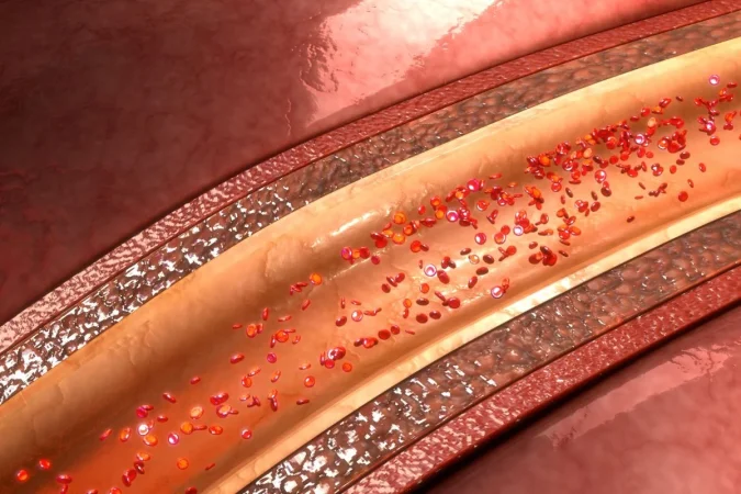 Tu rutina de 3 minutos al despertar: el ejercicio matutino que protege tus arterias 1 Merca2.es arterias112 Merca2.es