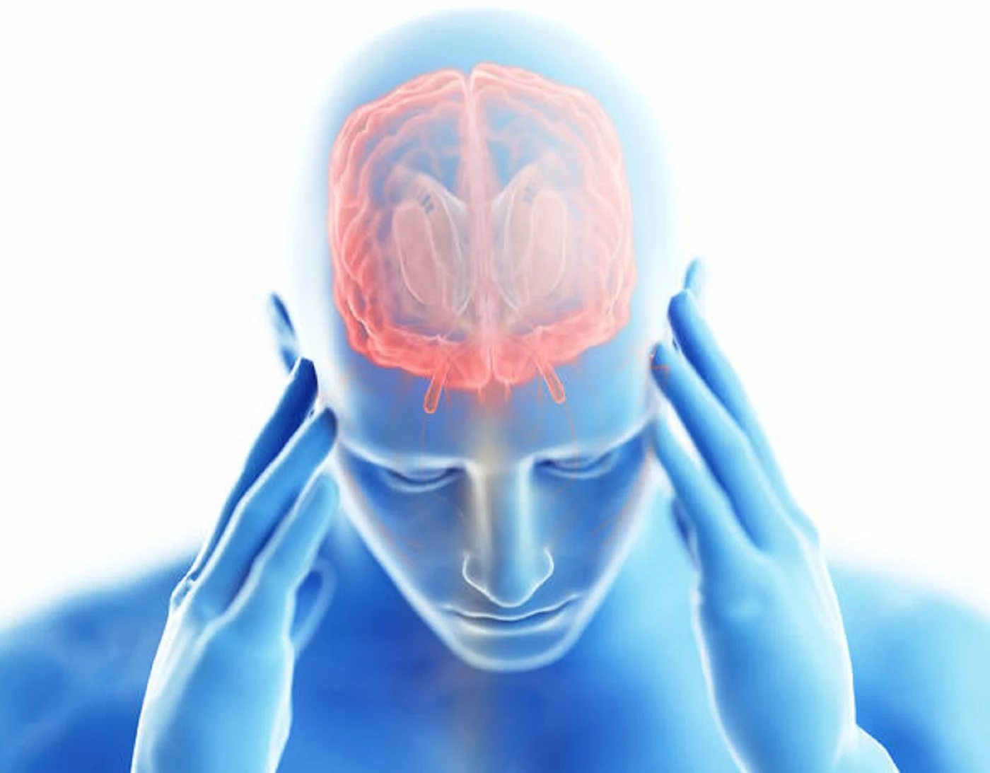 Casos de cefaleas Casos de cefaleas