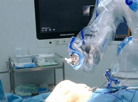 Robot ROSA Fuente: Quirónsalud