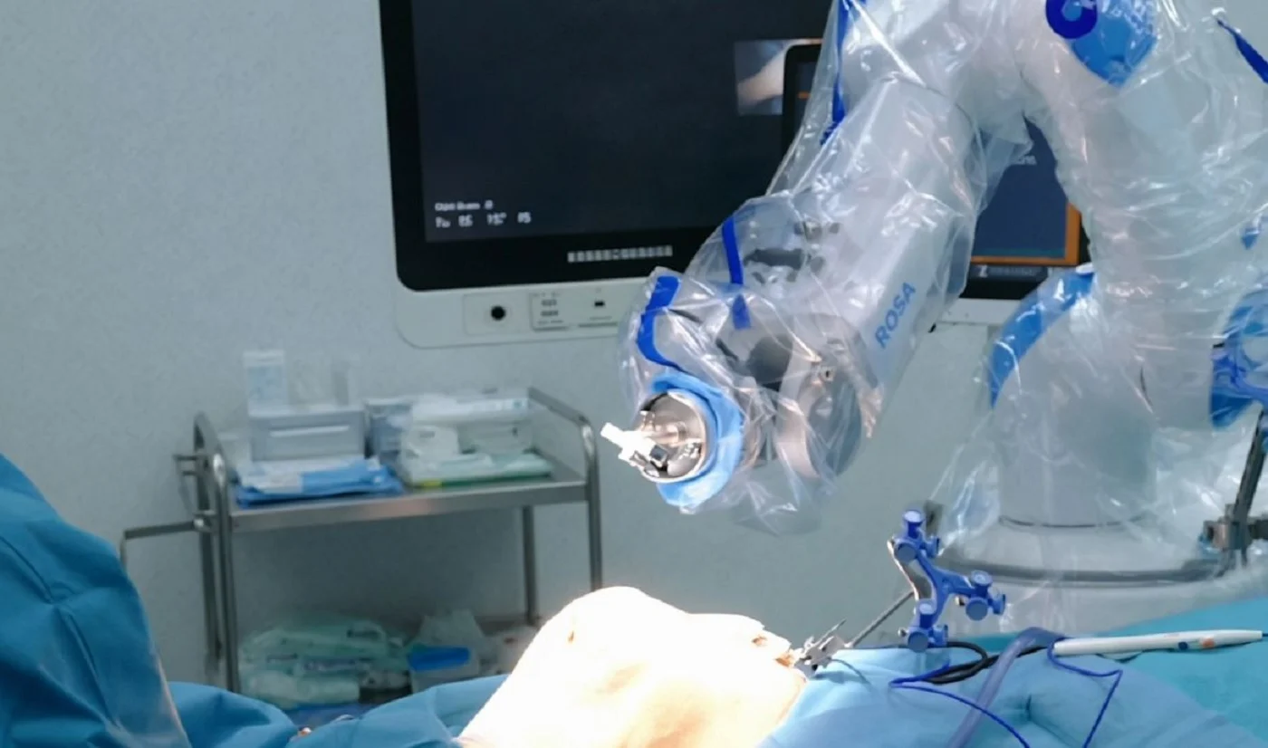 Robot ROSA Fuente: Quirónsalud