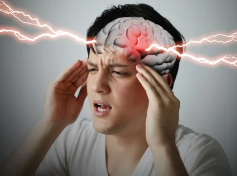 derrame cerebral 2