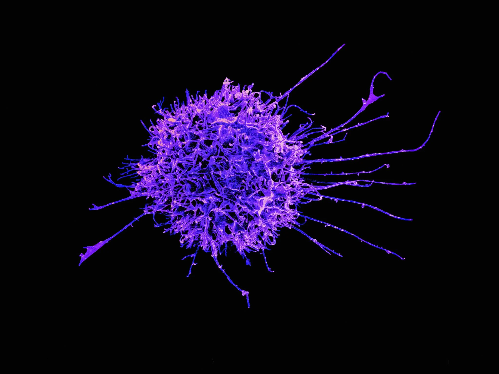 El tamaño celular modula la ferroptosis: hallazgo en eLife abre vías contra el cáncer 1 Merca2 muerte celular