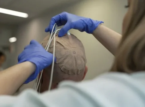 ensayo campos eléctricos inmunoterapia frente al glioblastoma