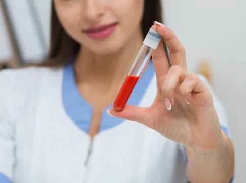 Este análisis de sangre que casi nadie se hace podría predecir tu riesgo cardiovascular antes de que aparezcan los síntomas Este análisis de sangre que casi nadie se hace podría predecir tu riesgo cardiovascular antes de que aparezcan los síntomas