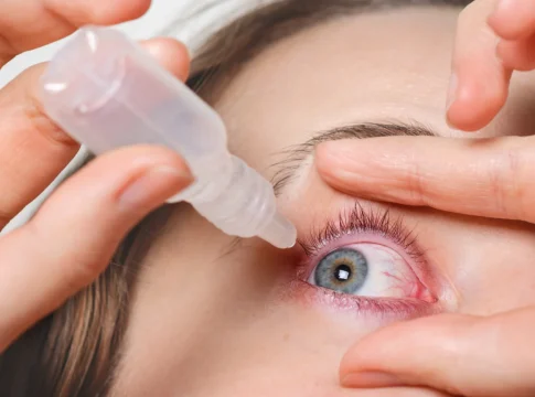 Farmacéuticos avisan: este colirio para el ojo rojo que usas en verano puede empeorar la irritación si abusas de él Farmacéuticos avisan: este colirio para el ojo rojo que usas en verano puede empeorar la irritación si abusas de él