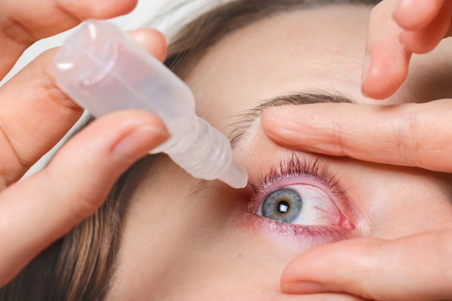 Farmacéuticos avisan: este colirio para el ojo rojo que usas en verano puede empeorar la irritación si abusas de él Farmacéuticos avisan: este colirio para el ojo rojo que usas en verano puede empeorar la irritación si abusas de él