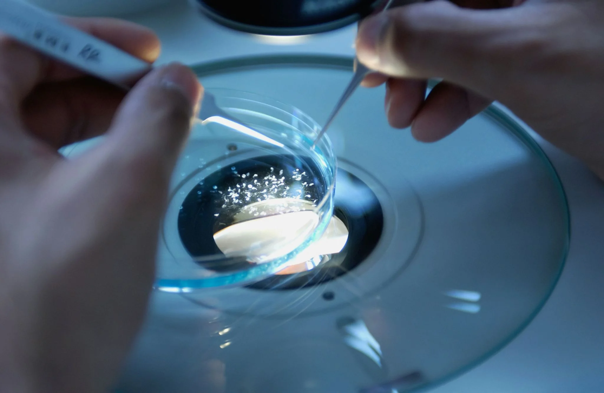 Envejecimiento, AMPK y longevidad: desacoplar la AMPK de la síntesis de grasas preserva la vitalidad en la vejez 1 Merca2 metabolismo ácidos grasos envejecimiento