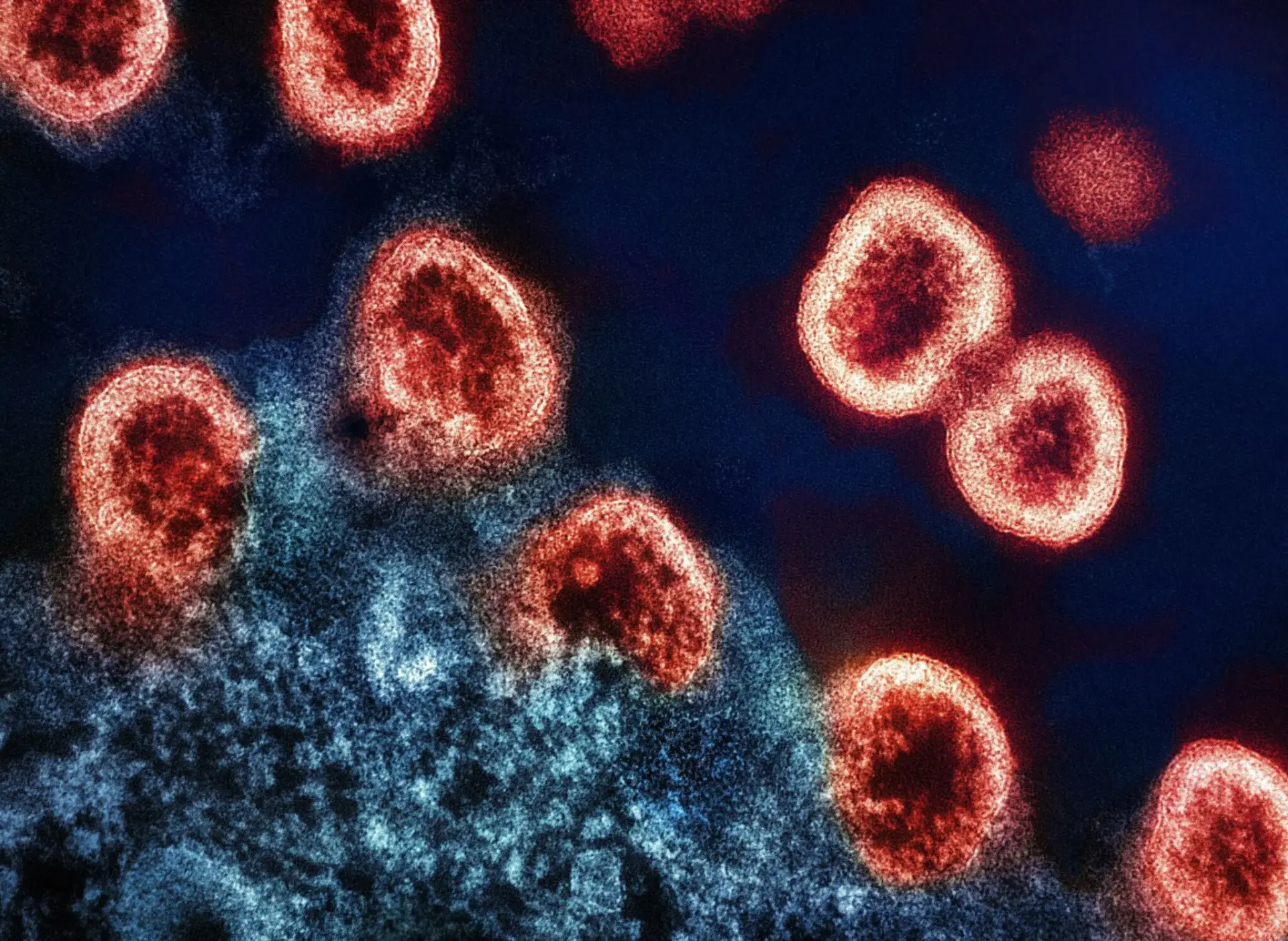 Estructuras celulares rojizas en imagen microscópica malaria glóbulos rojos