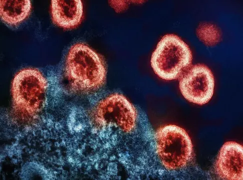 Estructuras celulares rojizas en imagen microscópica malaria glóbulos rojos